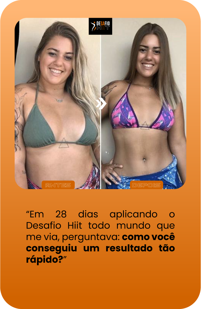 Depo2